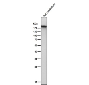 Western blot analysis of GRM1 expression using anti-GRM1 antibody in rat cerebellum tissue lysate. GRM1 has a predicted molecular weight of ~132 kDa; however, the mature receptor may be observed at higher apparent molecular weights, up to and above ~170 kDa, due to extensive N-linked glycosylation and the tendency of metabotropic glutamate receptors to form stable dimers or higher order complexes that can migrate above the predicted size on SDS-PAGE.