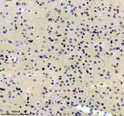 Immunohistochemical staining of FFPE rat brain tissue using ADAR antibody, HRP-secondary and DAB substrate. HIER: boil tissue sections in pH8 EDTA for 20 min and allow to cool before testing.