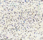 Immunohistochemical staining of FFPE mouse brain tissue using ADAR antibody, HRP-secondary and DAB substrate. HIER: boil tissue sections in pH8 EDTA for 20 min and allow to cool before testing.
