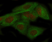 Immunofluorescent staining of FFPE human HeLa cells with ADAR antibody (red) and Beta Tubulin mAb (green). HIER: steam section in pH6 citrate buffer for 20 min.
