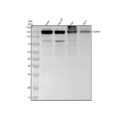 Western blot analysis of ADAR using anti-ADAR antibody. Samples include human HeLa cell lysate, human HepG2 cell lysate, rat brain tissue lysate, and human 293T cell lysate. Adenosine deaminase acting on RNA has a predicted molecular weight of approximately 134 kDa; however, a major band may be observed at approximately 150 kDa due to expression of higher molecular weight ADAR isoforms and phosphorylation-dependent mobility shifts that can increase apparent size on SDS-PAGE.