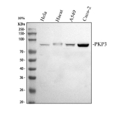 Western blot analysis using PKP3 antibody. Lane 1: human HeLa whole cell lysates; Lane 2: human HaCaT whole cell lysates; Lane 3: human A549 whole cell lysates; Lane 4: human Caco-2 whole cell lysates. The predicted molecular weight of Plakophilin 3 is ~87 kDa, and a band is observed at the expected size.