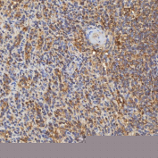 Immunohistochemical staining of FFPE human spleen tissue with RAB7A antibody, HRP-secondary and DAB substrate. HIER: boil tissue sections in pH8 EDTA for 20 min and allow to cool before testing.