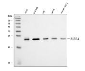 Western blot analysis using RAB7A antibody. Lane 1: human A375 whole cell lysates; Lane 2: human U-87MG whole cell lysates; Lane 3: human HEL whole cell lysates; Lane 4: rat L6 whole cell lysates; Lane 5: mouse C2C12 whole cell lysates. The predicted molecular weight of Ras-related protein Rab-7a is ~23 kDa, and a band is observed at the expected size.