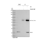 Immunoprecipitation of RAB7A protein from 500ug of human A431 whole cell lysate with 2ug of RAB7A antibody.
