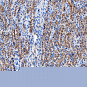 Immunohistochemical staining of FFPE mouse kidney tissue with RAB7A antibody, HRP-secondary and DAB substrate. HIER: boil tissue sections in pH8 EDTA for 20 min and allow to cool before testing.