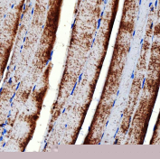 Immunohistochemical staining of FFPE mouse skeletal muscle tissue with RAB7A antibody, HRP-secondary and DAB substrate. HIER: boil tissue sections in pH8 EDTA for 20 min and allow to cool before testing.