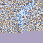 Immunohistochemical staining of FFPE rat kidney tissue with RAB7A antibody, HRP-secondary and DAB substrate. HIER: boil tissue sections in pH8 EDTA for 20 min and allow to cool before testing.