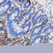 Immunohistochemical staining of FFPE rat colon tissue with RAB7A antibody, HRP-secondary and DAB substrate. HIER: boil tissue sections in pH8 EDTA for 20 min and allow to cool before testing.