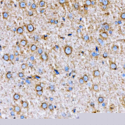 Immunohistochemical staining of FFPE rat brain tissue with RAB7A antibody, HRP-secondary and DAB substrate. HIER: boil tissue sections in pH8 EDTA for 20 min and allow to cool before testing.