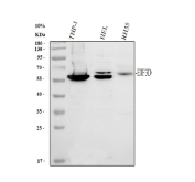 Western blot analysis using EIF3D antibody. Lane 1: human THP-1 whole cell lysate; Lane 2: human HEL whole cell lysate; Lane 3: rat RH35 whole cell lysate. The predicted molecular weight of EIF3D is ~64 kDa, while EIF3D antibody detects a dominant band at approximately 55-60 kDa on SDS-PAGE, with an additional weaker band in the low 60 kDa range. These bands are consistent with regulated forms of Eukaryotic translation initiation factor 3 subunit D.