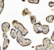 Immunohistochemical staining using EIF3D antibody on paraffin-embedded human placenta tissue sections. Heat-induced epitope retrieval was performed using EDTA buffer (pH 8.0) prior to antibody incubation. Sections were blocked and incubated with EIF3D antibody overnight at 4C. Detection was carried out using an HRP-based secondary antibody with DAB as the chromogen. Staining demonstrates cytoplasmic immunoreactivity in placental tissue. Nuclei were counterstained with hematoxylin.