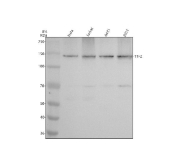 Western blot analysis of TTF2 using anti-TTF2 antibody. Lane 1: human HeLa whole cell lysate; Lane 2: human Jurkat whole cell lysate; Lane 3: human A431 whole cell lysate; Lane 4: human 293T whole cell lysate. A strong band is detected at approximately 130 kDa, consistent with the expected molecular weight of Transcription termination factor 2. A weaker lower molecular weight band around ~70 kDa can be observed, which may represent a truncated or processed form of TTF2.