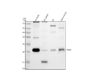 Western blot analysis of PRND using PRND antibody. Lane 1: rat testis tissue lysate; Lane 2: rat spleen tissue lysate; Lane 3: rat C6 whole cell lysate; Lane 4: mouse testis tissue lysate. A prominent band is detected at approximately 20 kDa, consistent with the expected molecular weight of Prion-like protein doppel. In addition, a lower molecular weight band around ~15 kDa and higher molecular weight species between ~60-80 kDa can be observed in a tissue-dependent manner, which may reflect processed, glycosylated, or mature forms of the GPI-anchored PRND protein.