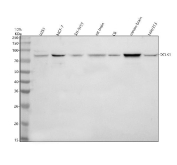 Western blot analysis of Doublecortin-like kinase 1 using Doublecortin-like kinase 1 antibody. Lane 1: human U251 whole cell lysates; Lane 2: human MCF-7 whole cell lysates; Lane 3: human SH-SY5Y whole cell lysates; Lane 4: rat brain tissue lysates; Lane 5: rat C6 whole cell lysates; Lane 6: mouse brain tissue lysates; Lane 7: human WPMY-1 whole cell lysates. A predominant band is detected at approximately 82 kDa, consistent with the expected molecular weight of Doublecortin-like kinase 1. The observed expression pattern aligns with known enrichment of DCLK1 in neuronal and selected epithelial cell types.
