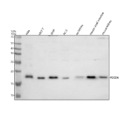 Western blot analysis of Programmed cell death protein 6 using PDCD6 antibody. Lane 1: human HeLa whole cell lysates; Lane 2: human MCF-7 whole cell lysates; Lane 3: human SiHa whole cell lysates; Lane 4: human PC-3 whole cell lysates; Lane 5: rat kidney tissue lysates; Lane 6: mouse small intestine tissue lysates; Lane 7: mouse kidney tissue lysates. A predominant band is detected at approximately 17 kDa across multiple samples. Although the predicted molecular weight of PDCD6 is ~22 kDa, PDCD6 is known to migrate at a lower apparent molecular weight on SDS-PAGE, likely due to its compact structure and calcium-binding EF-hand domains. The observed banding pattern is consistent with detection of PDCD6 in both human and rodent samples.