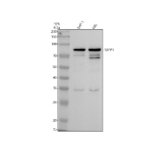 Western blot analysis of Relaxin receptor 1 using RXFP1 antibody. Lane 1: human THP-1 whole cell lysates; Lane 2: human HEL whole cell lysates. A prominent band is detected at approximately 85 kDa, consistent with the predicted molecular weight of Relaxin receptor 1. Additional lower-molecular-weight bands are observed at approximately 65-70 kDa and ~35 kDa, which may reflect partially glycosylated receptor forms or proteolytic fragments commonly reported for GPCR family members such as RXFP1. The overall banding pattern is consistent with detection of RXFP1 in human cell lysates.