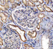 Immunohistochemistry analysis of Indian hedgehog protein using IHH antibody. Indian hedgehog protein expression was examined in a paraffin-embedded section of human kidney tissue. Heat-mediated antigen retrieval was performed using EDTA buffer (pH 8.0). Tissue sections were blocked with normal goat serum and incubated with IHH antibody overnight at 4Â°C. Immunoreactivity was visualized using an HRP-based detection system with DAB chromogen, followed by hematoxylin counterstaining.