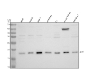 Western blot analysis of UFC1 using anti-UFC1 antibody. UFC1 antibody detects a specific band at approximately 19 kDa, consistent with the predicted molecular weight of Ubiquitin-fold modifier conjugating enzyme 1. Samples were resolved on a 12% SDS-PAGE gel under reducing conditions and transferred to a nitrocellulose membrane. Lane 1: human A549 whole cell lysates; Lane 2: human HepG2 whole cell lysates; Lane 3: human MCF-7 whole cell lysates; Lane 4: rat kidney tissue lysates; Lane 5: rat C6 whole cell lysates; Lane 6: mouse kidney tissue lysates; Lane 7: mouse Raw264.7 whole cell lysates. Detection was performed using HRP-based chemiluminescence, demonstrating consistent UFC1 expression across cell lines and tissues examined.