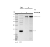 Immunoprecipitation of UFC1 protein from 500ug of human MCF7 whole cell lysate with 2ug of UFC1 antibody.