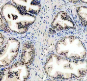IHC analysis of UBXN1 in human prostate hyperplasia tissue. UBXN1 expression was evaluated in a paraffin-embedded section of human prostate hyperplasia tissue. Heat-mediated antigen retrieval was carried out in EDTA buffer (pH 8.0), followed by blocking with 10% goat serum. Tissue sections were incubated with a rabbit anti-UBXN1 antibody overnight at 4Â°C. Signal detection was achieved using an HRP-conjugated secondary antibody with DAB chromogen, with hematoxylin counterstaining. UBXN1 staining is evident in glandular epithelial cells.