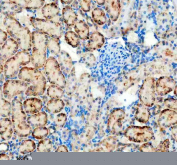 Immunohistochemistry analysis of Platelet-derived growth factor D using PDGF-D antibody. Platelet-derived growth factor D expression was examined in a paraffin-embedded section of rat kidney tissue. Heat-mediated antigen retrieval was performed using EDTA buffer (pH 8.0). Tissue sections were blocked with normal goat serum and incubated with PDGF-D antibody overnight at 4C. Immunoreactivity was visualized using an HRP-based detection system with DAB chromogen, followed by hematoxylin counterstaining.