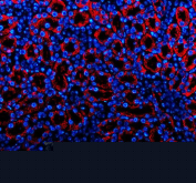 Immunofluorescence analysis of Platelet-derived growth factor D using PDGF-D antibody. Platelet-derived growth factor D expression was examined in a paraffin-embedded section of mouse kidney tissue. Heat-mediated antigen retrieval was performed using EDTA buffer (pH 8.0). Tissue sections were blocked with normal goat serum and incubated with PDGF-D antibody (red) overnight at 4C. Immunoreactivity was visualized using fluorescence detection, and nuclei were counterstained with DAPI (blue).