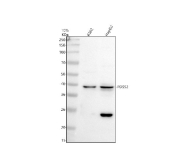 Western blot analysis of PDSS2 using PDSS2 antibody.Protein lysates from human K562 cells (Lane 1) and human HepG2 cells (Lane 2) were resolved by SDS-PAGE under reducing conditions and transferred to a nitrocellulose membrane. PDSS2 was detected as a major band at approximately 39 kDa, which runs slightly below the predicted molecular weight of Prenyl diphosphate synthase subunit 2. This modest shift is consistent with common gel-to-gel mobility differences and the fact that apparent SDS-PAGE migration can differ from sequence-based predictions depending on protein composition and sample preparation. An additional lower molecular weight band at approximately 25 kDa is observed in HepG2 lysate, which may reflect a PDSS2-derived cleavage product or a shorter PDSS2-related species present under certain cellular or lysis conditions. Detection was performed using an HRP-based secondary antibody and chemiluminescent substrate.
