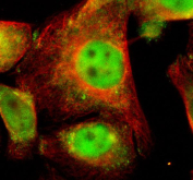 Immunofluorescence analysis of UCHL3 using UCHL3 antibody and Alpha Tubulin antibody. UCHL3 expression was examined in cultured HeLa cells. Enzymatic antigen retrieval was performed prior to staining. Cells were blocked with normal goat serum and incubated with UCHL3 antibody (green) and Alpha Tubulin antibody (red) overnight at 4C. Immunoreactivity was visualized by fluorescence microscopy, showing UCHL3 localization in both the cytoplasm and nucleus, while Alpha Tubulin highlights the cytoskeletal network.