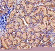 Immunohistochemistry analysis of Protein pelota homolog using PELO antibody. PELO expression was examined in a paraffin-embedded section of rat kidney tissue. Heat-mediated antigen retrieval was performed using EDTA buffer (pH 8.0). Tissue sections were blocked with normal goat serum and incubated with PELO antibody overnight at 4C. Immunoreactivity is observed predominantly in renal tubular epithelial cells, with minimal staining in surrounding stromal areas. Detection was visualized using an HRP-based detection system with DAB chromogen, followed by hematoxylin counterstaining.