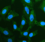 Immunofluorescence analysis of Phosphodiesterase 8B using PDE8B antibody. PDE8B expression was examined in cultured HeLa cells. Enzymatic antigen retrieval was performed prior to staining. Cells were blocked with normal goat serum and incubated with PDE8B antibody (green) overnight at 4C. Immunoreactivity was visualized by fluorescence microscopy, and nuclei were counterstained with DAPI (blue).