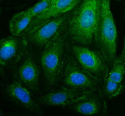 Immunofluorescence analysis of Peroxisomal biogenesis factor 14 using PEX14 antibody. PEX14 expression was examined in cultured U2OS cells. Enzymatic antigen retrieval was performed prior to staining. Cells were blocked with normal goat serum and incubated with PEX14 antibody (green) overnight at 4C. Immunoreactivity shows a cytoplasmic, punctate staining pattern consistent with peroxisomal membranes, and nuclei were counterstained with DAPI (blue).
