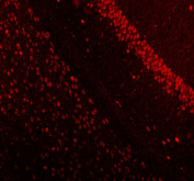 Immunofluorescence analysis of MECP2 using Methyl-CpG-binding protein 2 antibody. MECP2 expression was examined in mouse brain tissue, with strong nuclear fluorescence observed in neuronal cells. Heat-mediated antigen retrieval was performed using EDTA buffer (pH 8.0). Tissue sections were blocked with normal goat serum and incubated with MECP2 antibody (red) overnight at 4Â°C. Immunoreactivity was visualized using fluorescence detection.