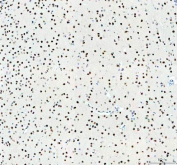 Immunohistochemistry analysis of MECP2 using Methyl-CpG-binding protein 2 antibody. MECP2 expression was examined in mouse brain tissue, with prominent nuclear staining observed in neuronal cells throughout the cortex. Heat-mediated antigen retrieval was performed using EDTA buffer (pH 8.0). Tissue sections were blocked with normal goat serum and incubated with MECP2 antibody overnight at 4Â°C. Immunoreactivity was visualized using an HRP-based detection system with DAB chromogen, followed by hematoxylin counterstaining.