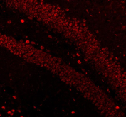 Immunofluorescence analysis of MECP2 using Methyl-CpG-binding protein 2 antibody. MECP2 expression was examined in mouse brain tissue, with strong nuclear fluorescence observed in neuronal cells. Heat-mediated antigen retrieval was performed using EDTA buffer (pH 8.0). Tissue sections were blocked with normal goat serum and incubated with MECP2 antibody (red) overnight at 4Â°C. Immunoreactivity was visualized using fluorescence detection.