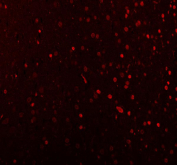 Immunofluorescence analysis of MECP2 using Methyl-CpG-binding protein 2 antibody. MECP2 expression was examined in rat brain tissue, showing nuclear localization within neuronal populations. Heat-mediated antigen retrieval was performed using EDTA buffer (pH 8.0). Tissue sections were blocked with normal goat serum and incubated with MECP2 antibody (red) overnight at 4Â°C. Immunoreactivity was visualized using fluorescence detection.