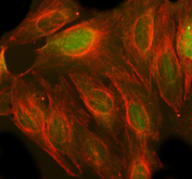 Immunofluorescence analysis of MECP2 using Methyl-CpG-binding protein 2 antibody and alpha tubulin antibody. MECP2 expression was examined in human U2OS cells, with MECP2 signal observed in the nucleus and alpha tubulin outlining the cytoplasmic microtubule network. Cells were blocked with normal goat serum and incubated with MECP2 antibody (green) and alpha tubulin antibody (red) overnight at 4Â°C. Immunoreactivity was visualized using fluorescence detection.