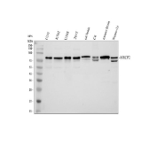 Western blot analysis of MECP2 using Methyl-CpG-binding protein 2 antibody. MECP2 expression was examined in human U251 (lane 1), K562 (lane 2), U2OS (lane 3), and HEK293T (lane 4) whole cell lysates, as well as rat brain tissue (lane 5), rat C6 cells (lane 6), mouse brain tissue (lane 7), and mouse Neuro-2a cells (lane 8). A predominant band is detected at approximately 75 kDa, migrating above the predicted molecular weight of approximately 52 kDa based on the MECP2 amino acid sequence. This upward shift is consistent with the well-documented anomalous SDS-PAGE migration of MECP2, which is attributed to its high content of intrinsically disordered regions, basic residues, and extensive post-translational modifications such as phosphorylation, all of which are known to increase the apparent molecular weight of chromatin-associated proteins.