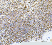 IHC analysis of c-Myc in human spleen tissue. Paraffin-embedded human spleen tissue was stained with c-Myc / MYC antibody following pH8 EDTA heat-mediated antigen retrieval. Nuclear immunoreactivity is observed in lymphoid cells, consistent with endogenous c-Myc expression. Scale bar: 100 um.