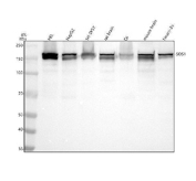 Son of Sevenless 1 Antibody / SOS1 western blot analysis. Lane 1: human HEL whole cell lysate, Lane 2: human HepG2 whole cell lysate, Lane 3: human SH-SY5Y whole cell lysate, Lane 4: rat brain tissue lysate, Lane 5: rat C6 whole cell lysate, Lane 6: mouse brain tissue lysate, Lane 7: mouse Neuro-2a whole cell lysate. Proteins were separated by SDS-PAGE on an 8% gel under reducing conditions and transferred to a nitrocellulose membrane. The membrane was blocked with 5% non-fat milk in TBS and incubated with rabbit monoclonal Son of Sevenless 1 antibody overnight at 4oC, followed by HRP-conjugated goat anti-rabbit secondary antibody detection and chemiluminescent substrate development. A band is detected at approximately 170 kDa, consistent with the predicted molecular weight of Son of Sevenless 1 / SOS1 of approximately 152 kDa. SOS1 frequently appears as a doublet on western blot due to phosphorylation-dependent mobility shifts associated with activation of Ras signaling pathways. The presence of SOS1 in brain tissue lysates and neuronal cell lines is consistent with the known role of this Ras guanine nucleotide exchange factor in receptor tyrosine kinase signaling and MAPK pathway activation.