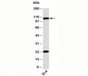 Western blot testing of mouse samples with TLR9 antibody at 2ug/ml.