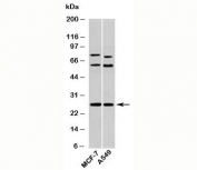 Syndecan 4 antibody western blot of human samples