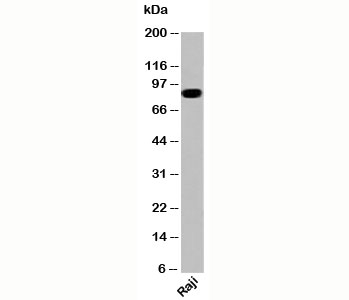 Western blot testing of human samples with IKKb antibody IKB355 at 2ug/ml.