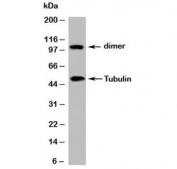Western blot testing of mouse samples with beta Tubulin antibody at 2ug/ml. Predicted molecular weight: 50-55 kDa.