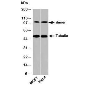 Western blot testing of human samples with beta Tubulin antibody at 2ug/ml. Predicted molecular weight: 50-55 kDa.~