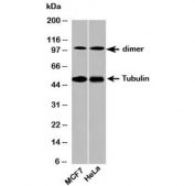 Western blot testing of human samples with beta Tubulin antibody at 2ug/ml. Predicted molecular weight: 50-55 kDa.