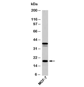 Western blot testing of human samples with AGR2 antibody at 5ug/ml. Expected molecular weight: 17-20 kDa.~
