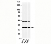 CLEC4E antibody western blot of human samples