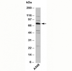 Western blot testing of human samples with TNFAIP2 antibody at 4ug/ml.