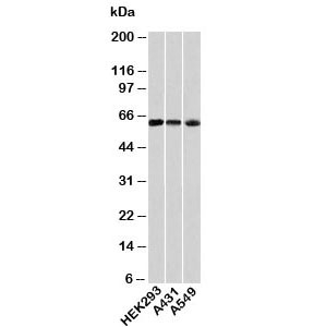 Western blot testing of human samples with HSP60 antibody at 1ug/ml.